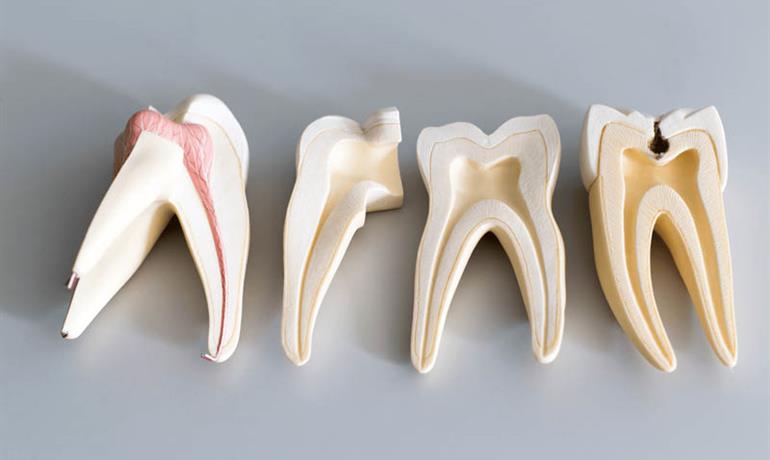جراحی و درمان ریشه دندان ناموفق
